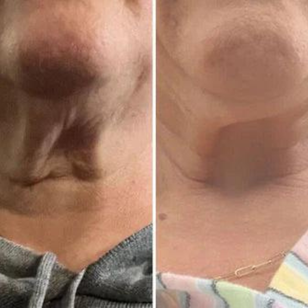 RejuveNeck - Crema lifting de cuello con rodillo