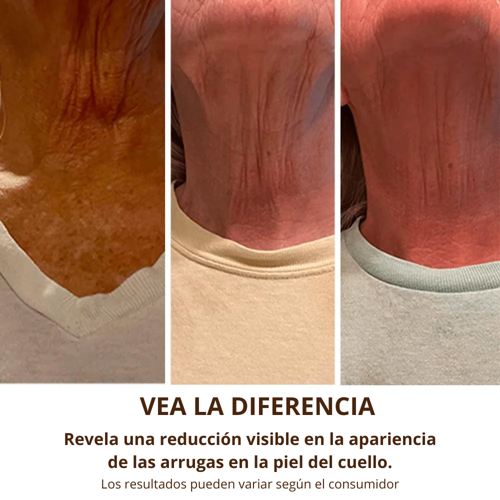RejuveNeck - Crema lifting de cuello con rodillo