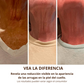 RejuveNeck - Crema lifting de cuello con rodillo